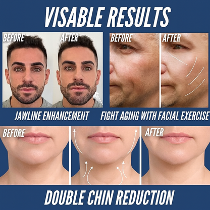 Jawnetic™ - Jaw Enhancement Product